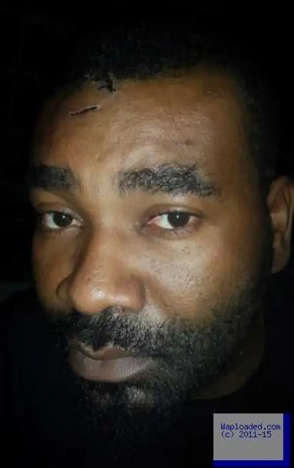 Photos: "I Saw Death Face To Face" - See What Kidnappers Did To Actor Prince Eke